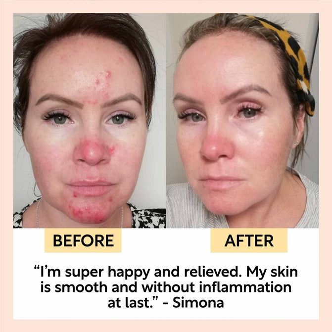 Upcircle Night Cream with Hyaluronic Acid + Niacinamide