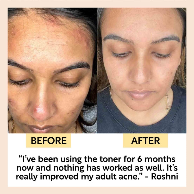 Upcircle Face Toner with Hyaluronic Acid